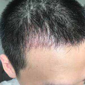 发际线分享社区