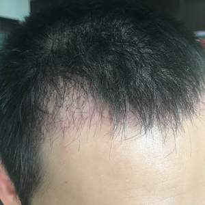 发际线分享社区