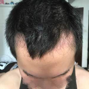 发际线分享社区