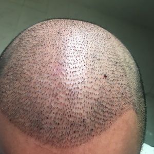 发际线分享社区