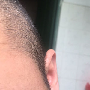 发际线分享社区