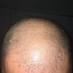 发际线分享社区
