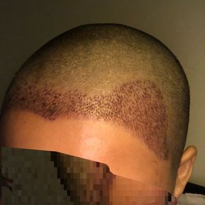 发际线分享社区
