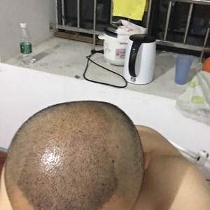 发际线分享社区