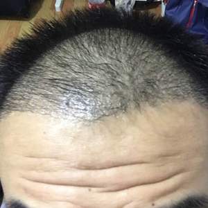 发际线分享社区