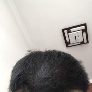 发际线分享社区