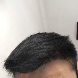 发际线分享社区