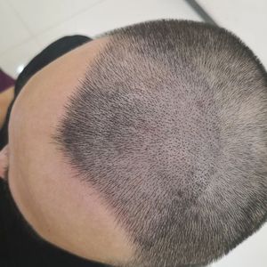 发际线分享社区
