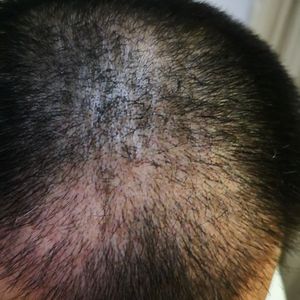发际线分享社区