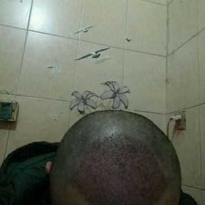发际线分享社区