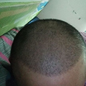 发际线分享社区