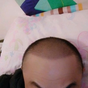 发际线分享社区