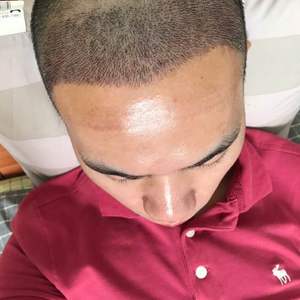 发际线分享社区