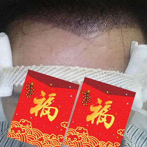 发际线分享社区