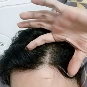 发际线分享社区