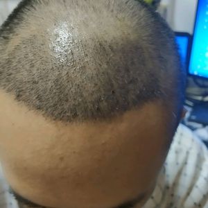 发际线分享社区