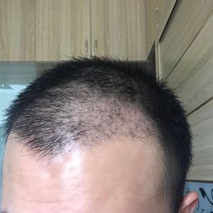发际线分享社区