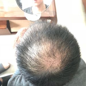 发际线分享社区