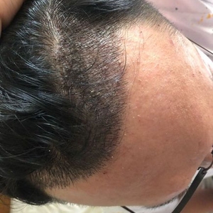 发际线分享社区