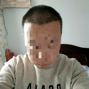 发际线分享社区