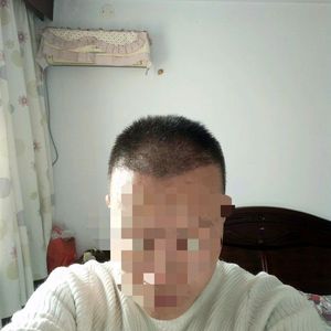 发际线分享社区