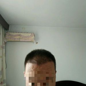发际线分享社区