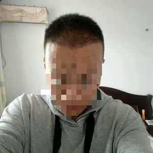 发际线分享社区