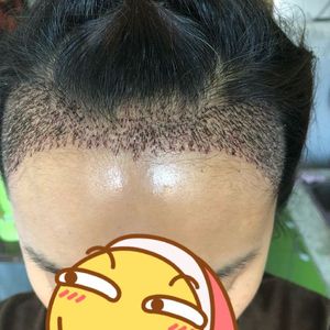 发际线分享社区