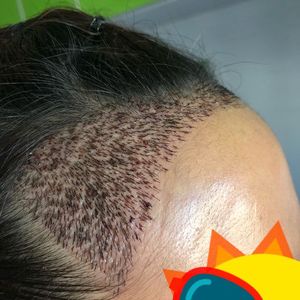 发际线分享社区