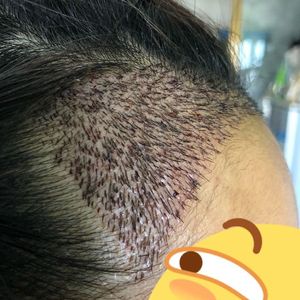 发际线分享社区