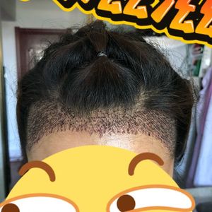 发际线分享社区
