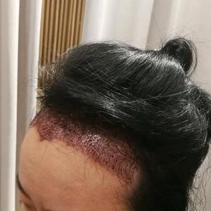 发际线分享社区