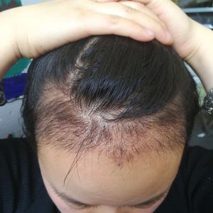 发际线分享社区