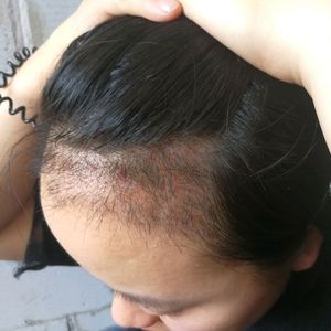 发际线分享社区