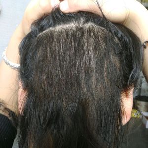 发际线分享社区