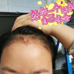发际线分享社区
