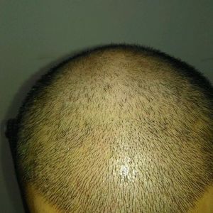 发际线分享社区