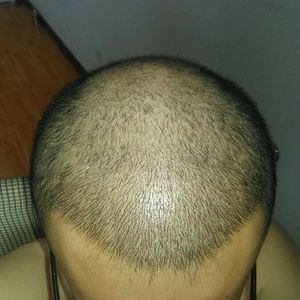 发际线分享社区
