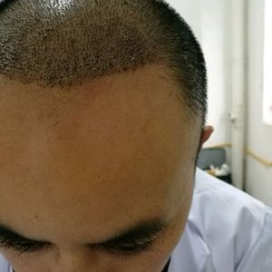 发际线分享社区