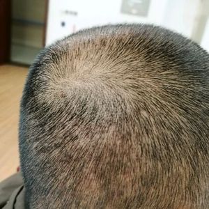 发际线分享社区