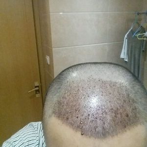发际线分享社区