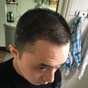 发际线分享社区