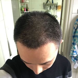 发际线分享社区