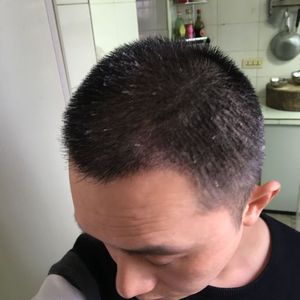 发际线分享社区