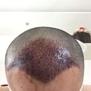 发际线分享社区