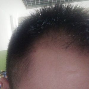 发际线分享社区