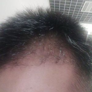 发际线分享社区