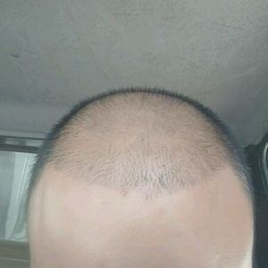 发际线分享社区