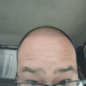 发际线分享社区