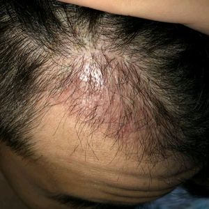 发际线分享社区